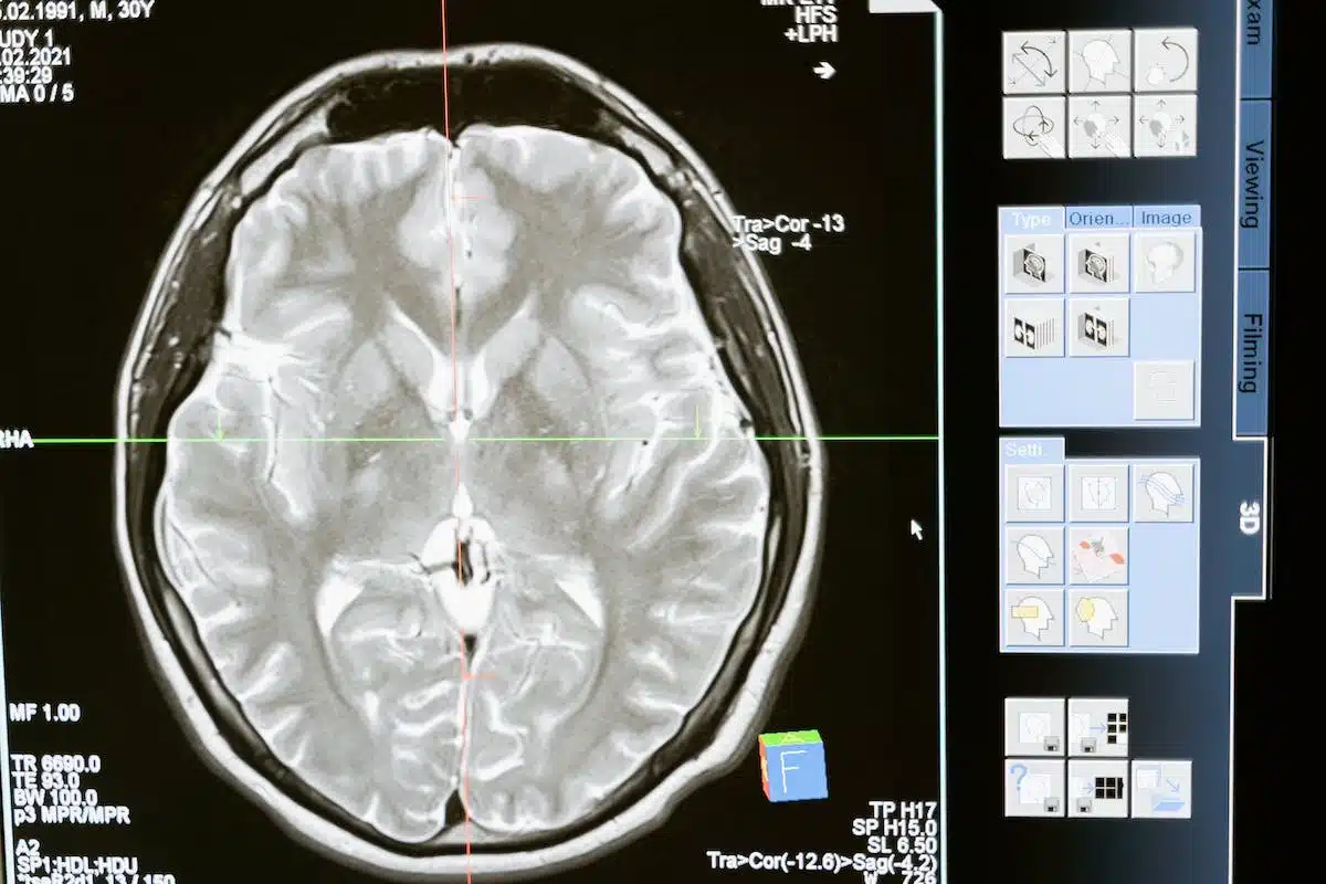 mémoire cerveau